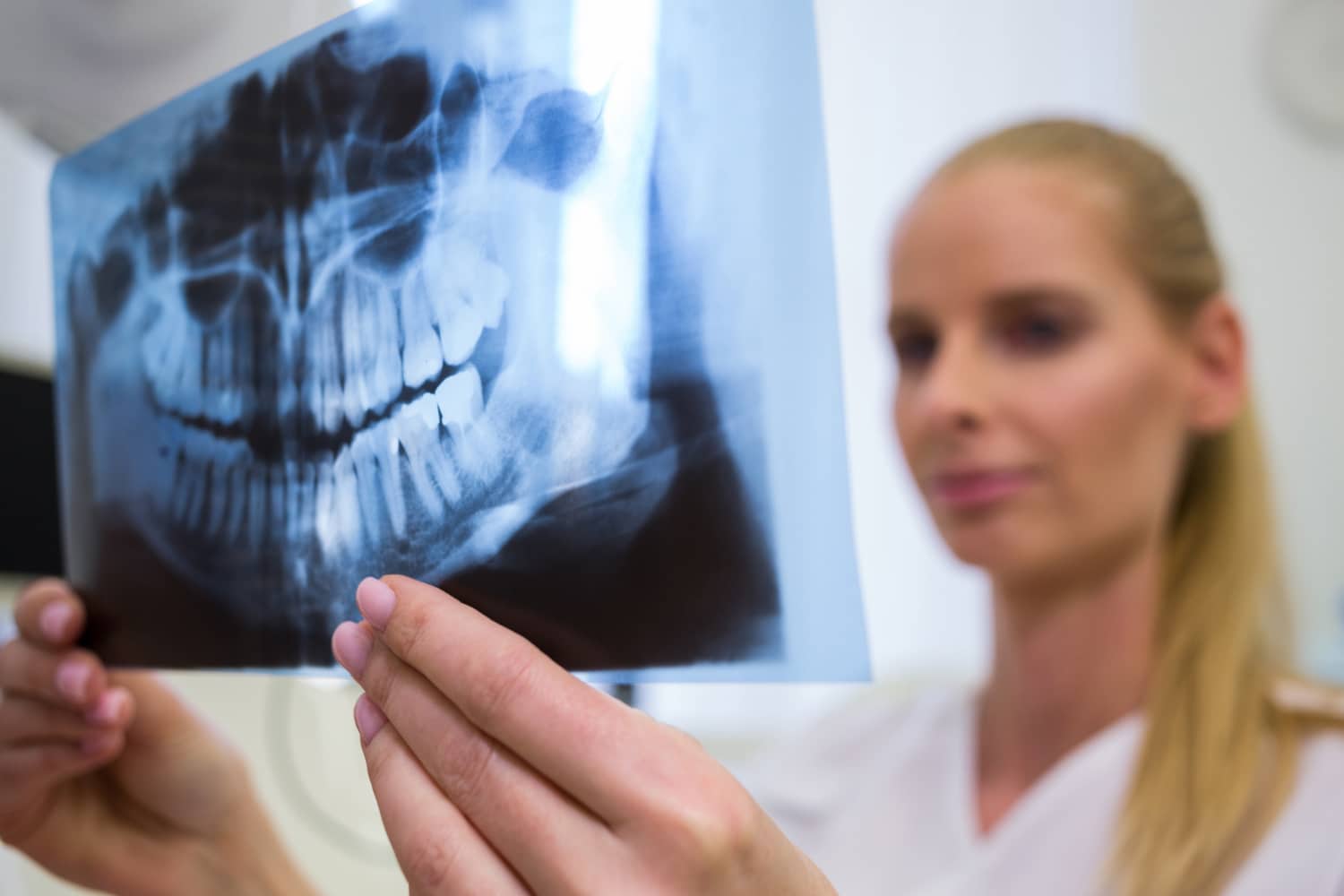 Regeneración Ósea Dental: ¿Por Qué Deberías Considerarla?